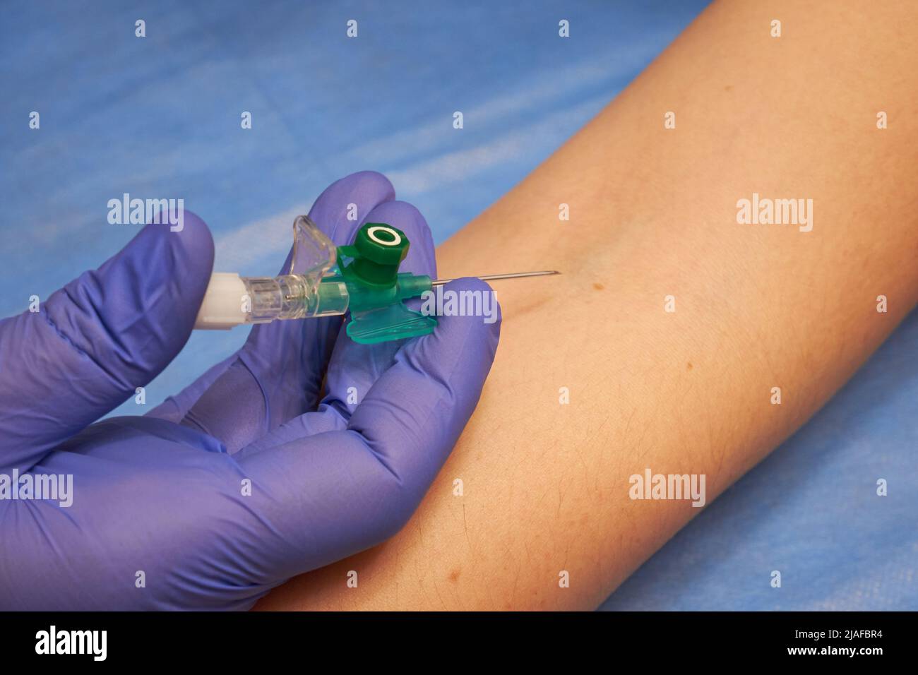 Preparation for vein catheterization close up. Intravenous catheter in