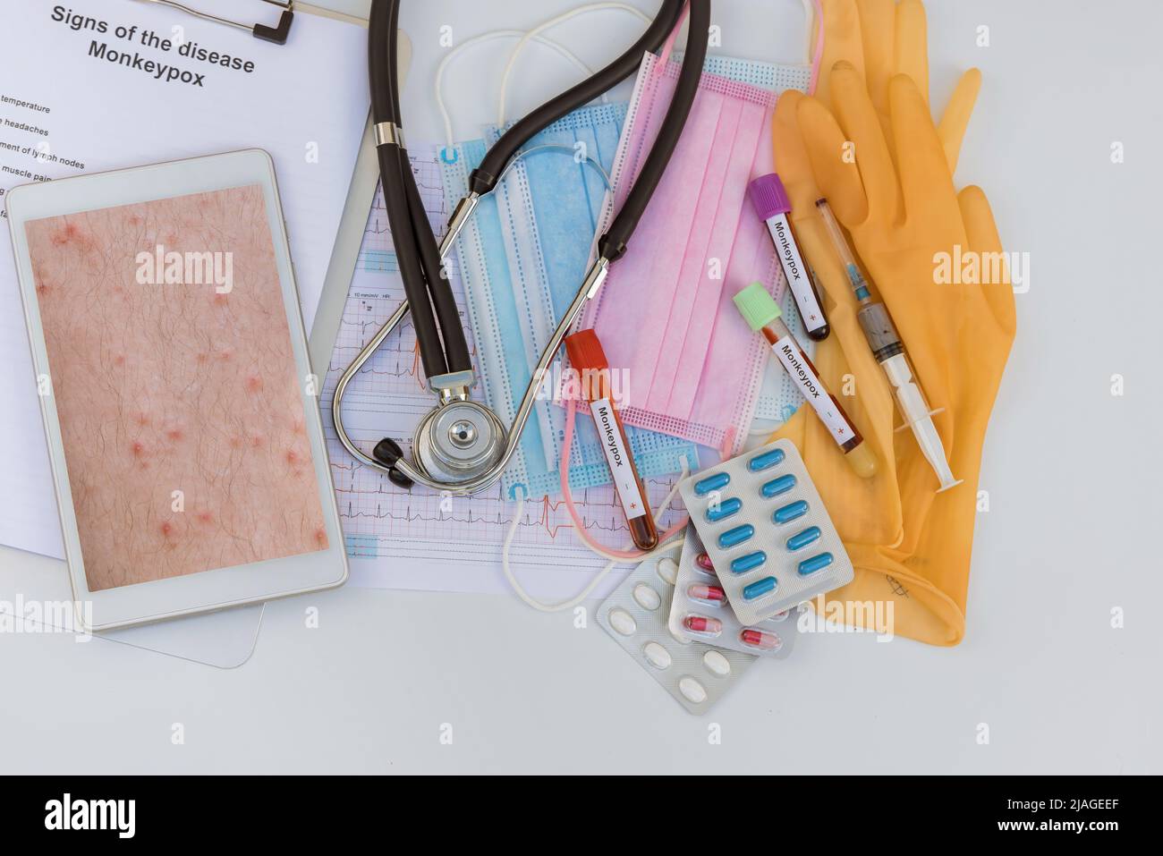 Sample blood test of Monkeypox with doctor examination patient in skin