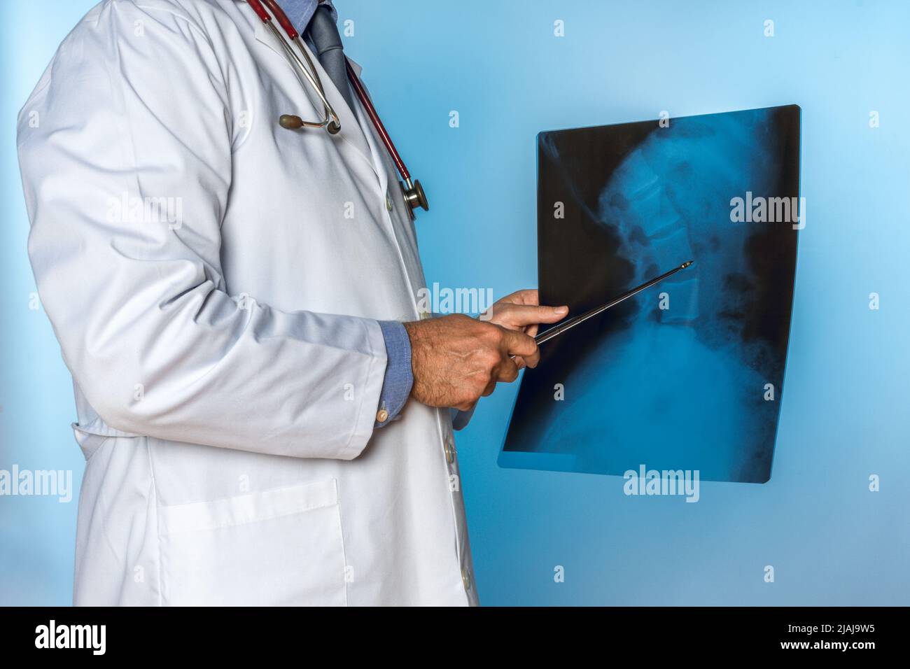 unrecognizable doctor pointing to an x-ray of a person's spine Stock Photo