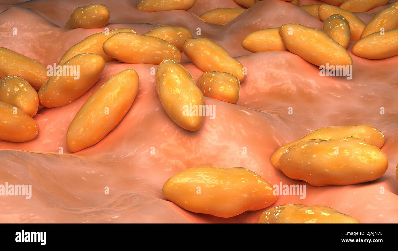 Conceptual biomedical illustration of brucellosis, also known as Malta fever. Stock Photo