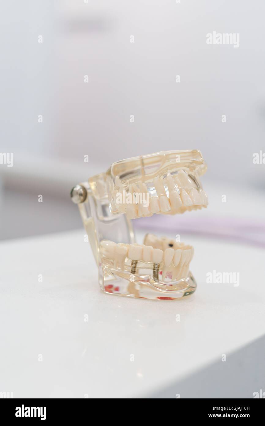 Medical object in studio, modeled glass denture, dental article for didactic means, details of teeth, molars, gums and bite Stock Photo