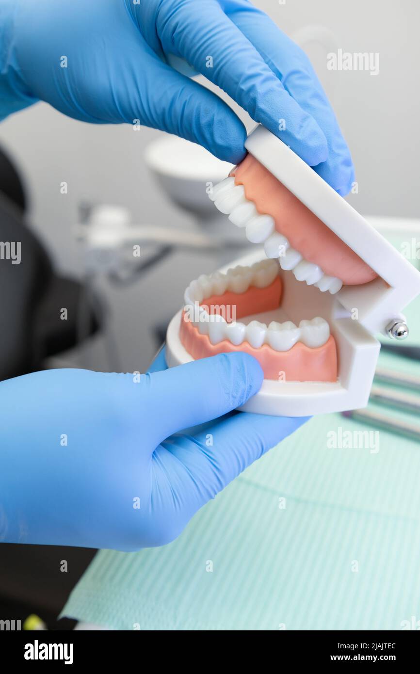 workplace with detail of a gloved hand showing the bite of an artificial prosthesis, detail of teeth, molars, gums and smile design, dentist tool Stock Photo