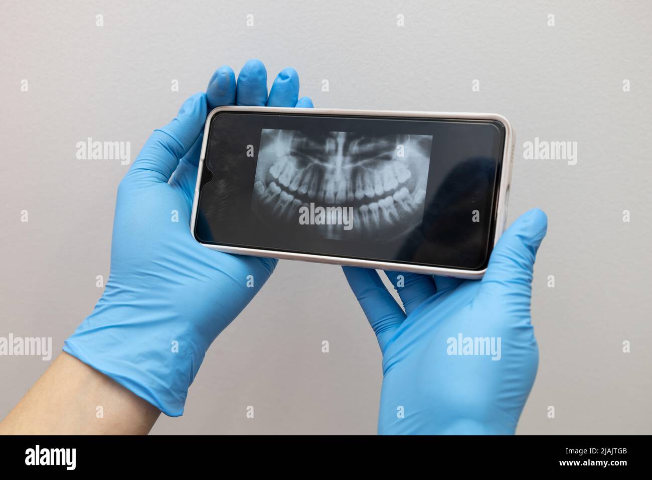 x-ray examination results on mobile device of a person's mouth, examining for dental treatment, technology Stock Photo