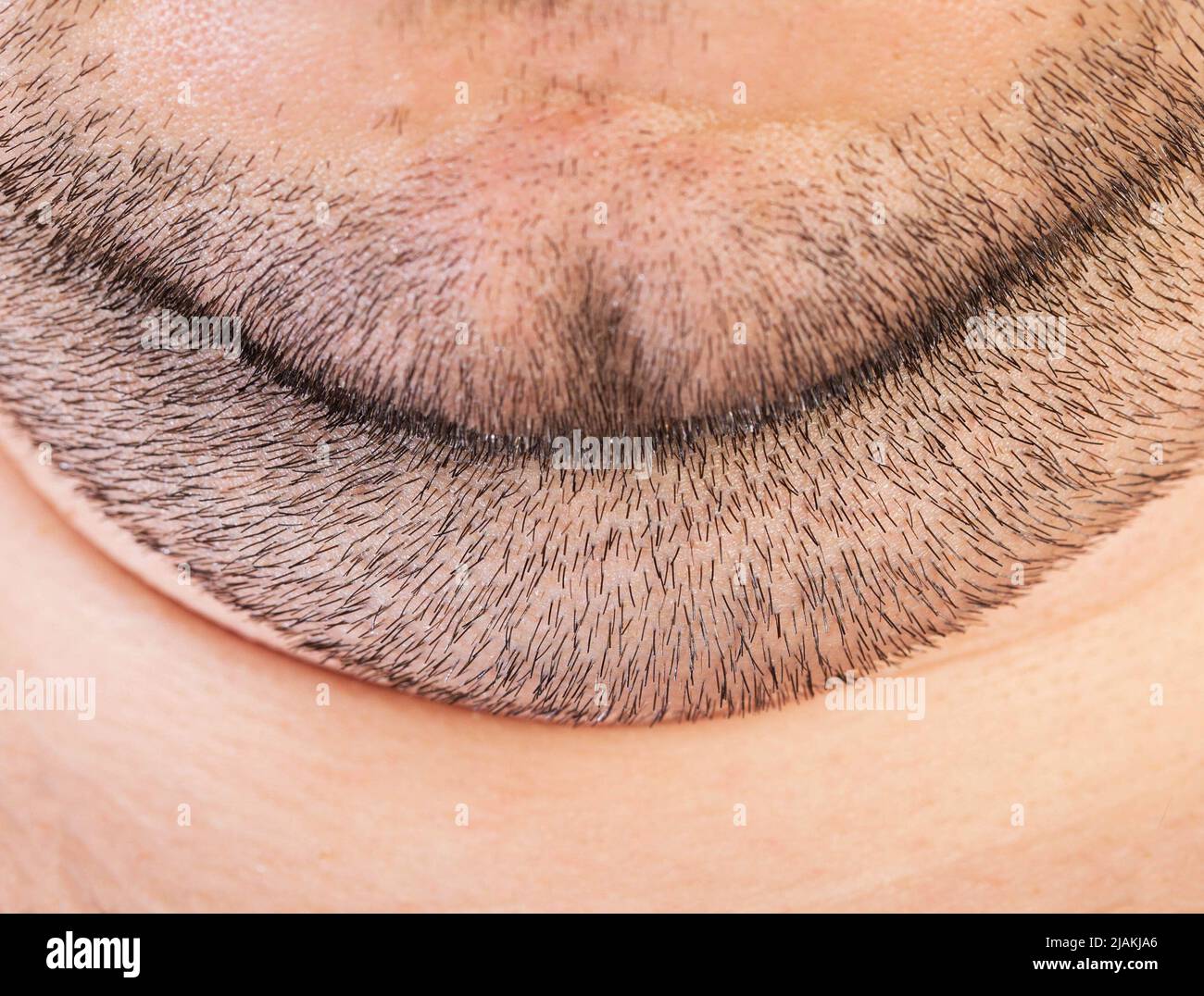Thick double chin with stubble on the face. Aesthetic defect, chin correction exercises Stock Photo