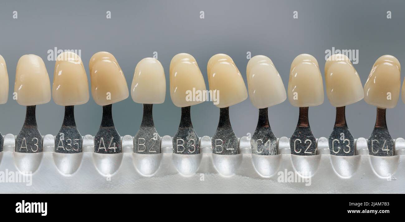 closeup of a shade guide to check veneer of tooth crown or implant in dental laboratory Stock