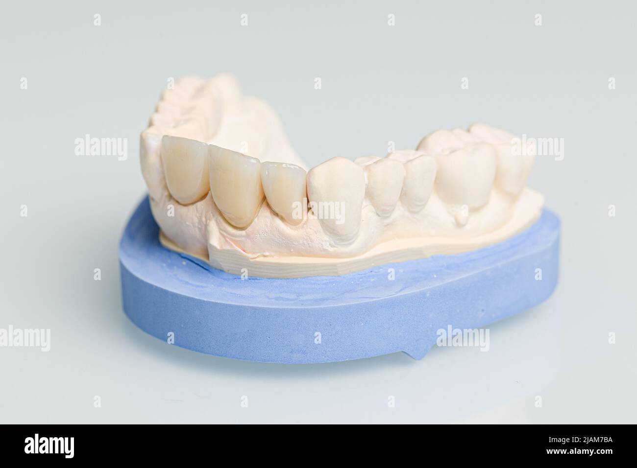 close up of tooth crown or implant in dental laboratory Stock Photo Alamy