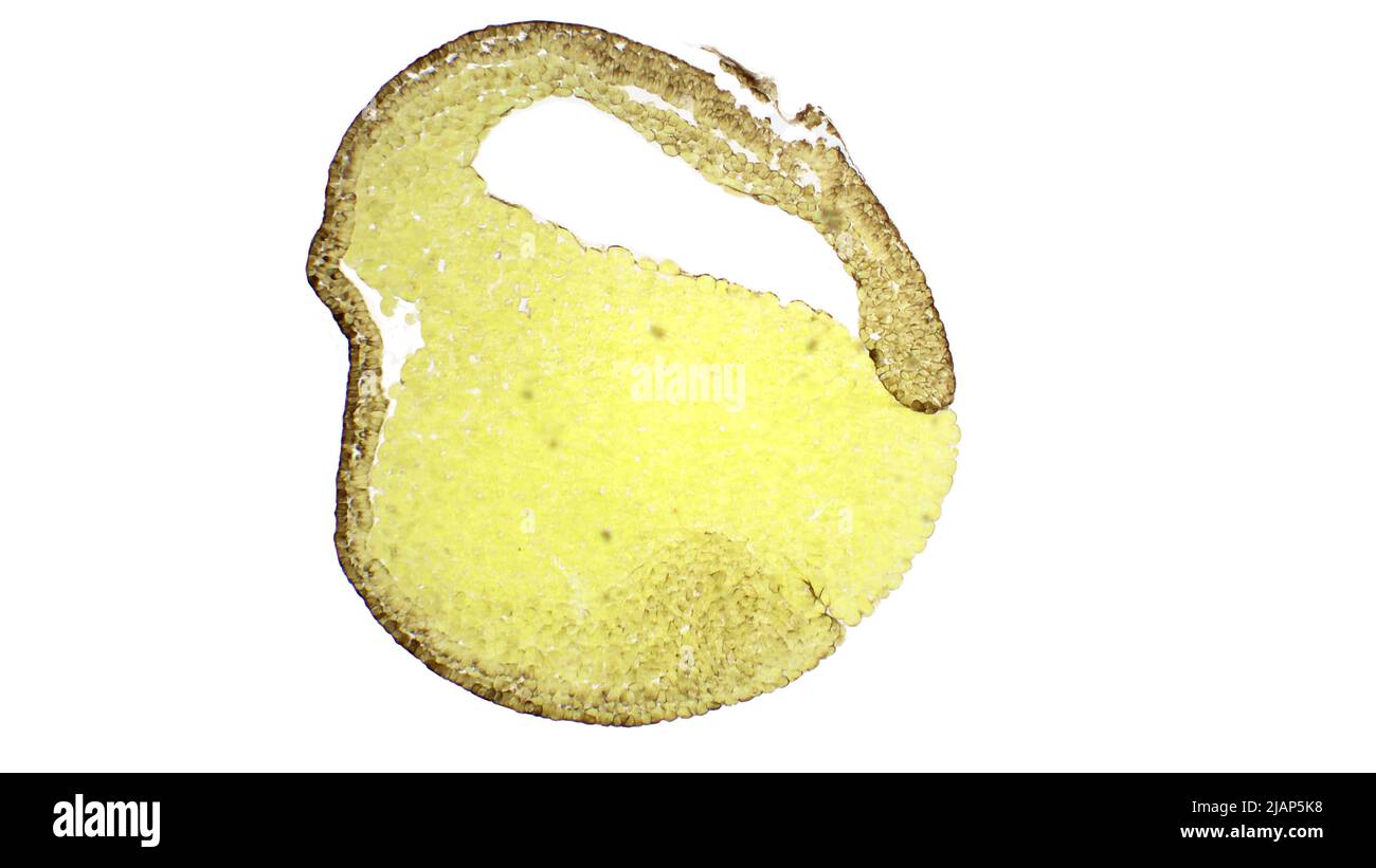Gastrulation. Frog development.  Medium gastrula stage. The frog been used as a model organism for the study of gastrulation. Van Gieson's stain. Stock Photo