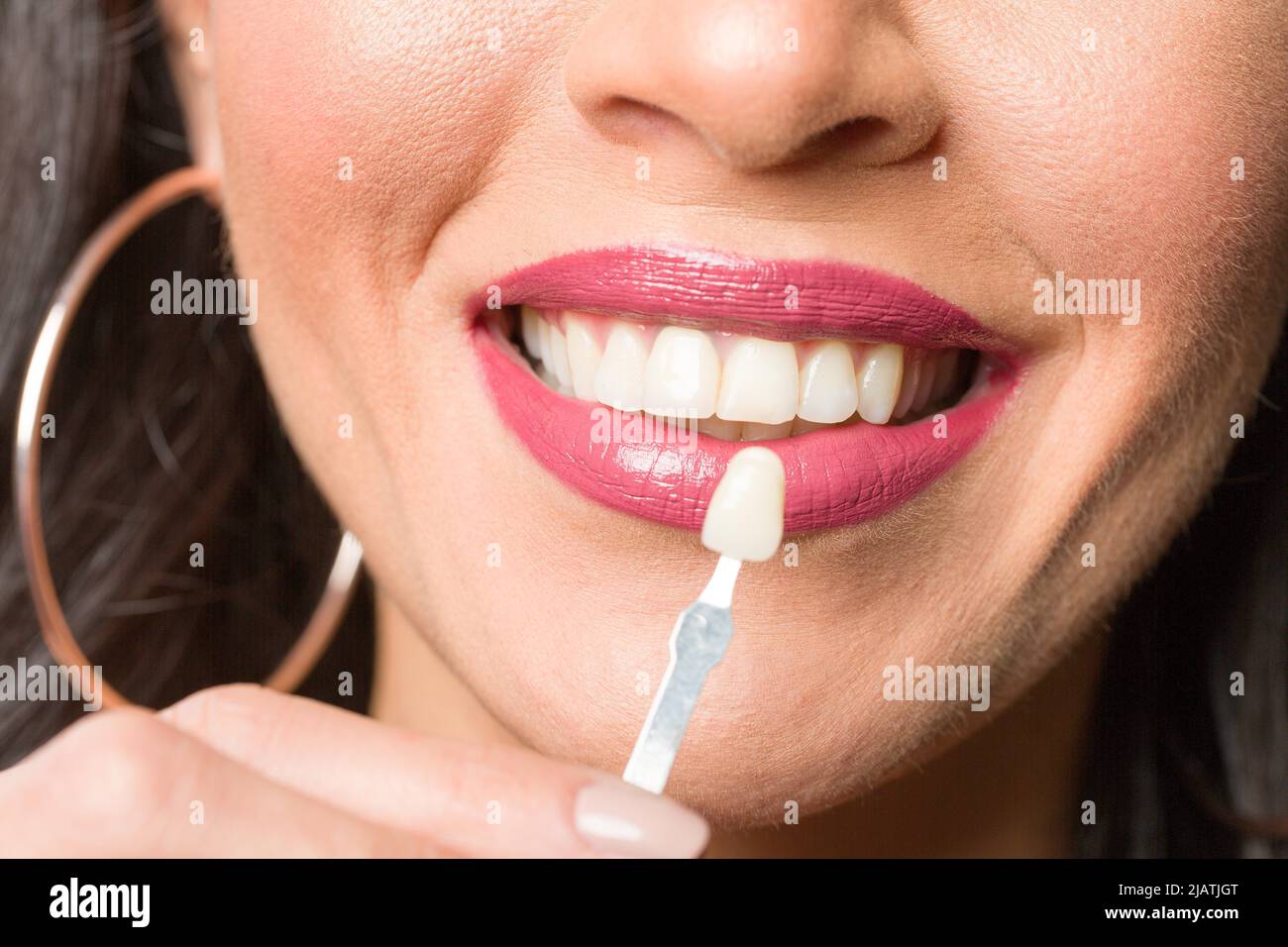 Closeup of dentist's hand using shade guide at woman's mouth to check