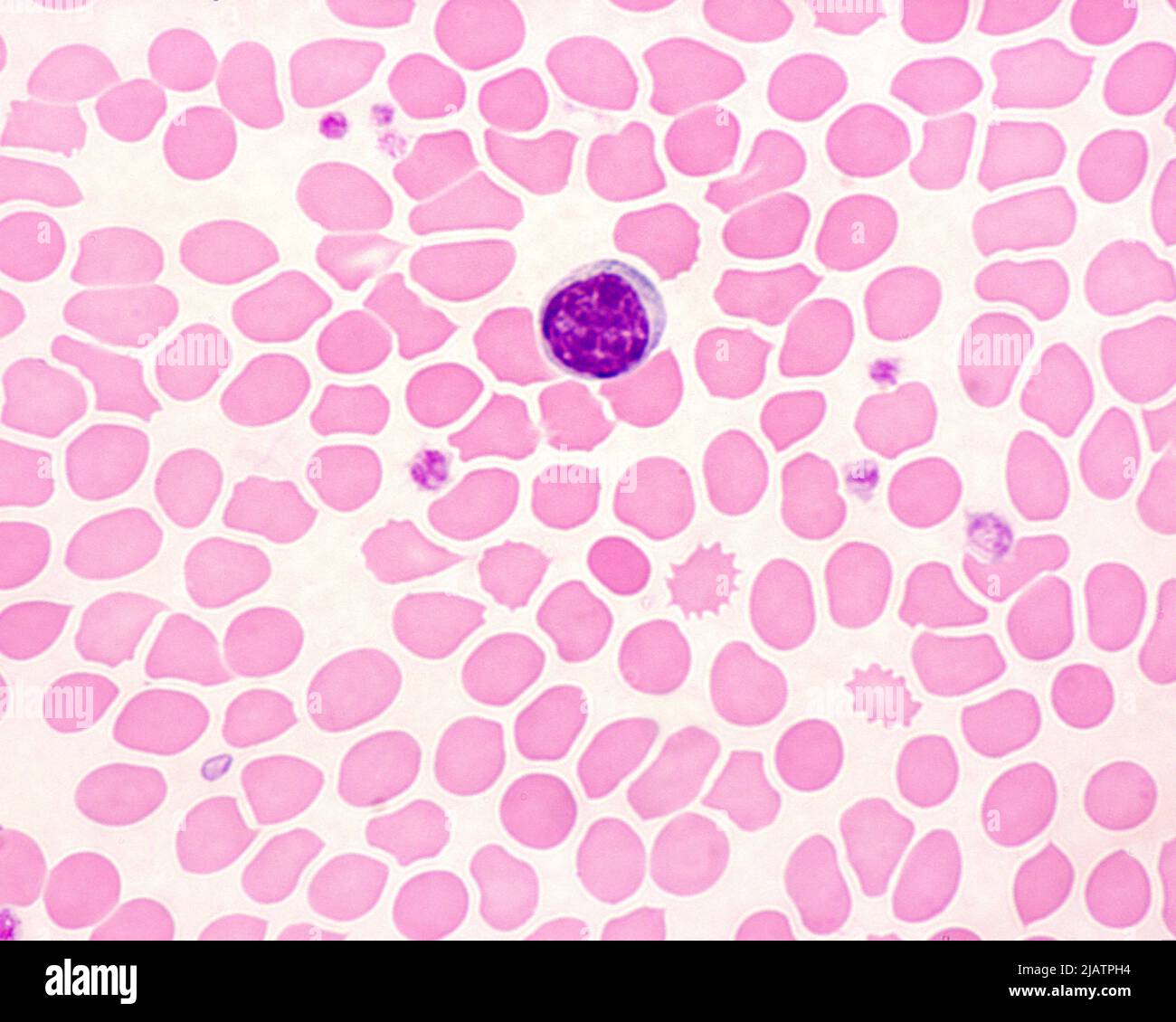 Human blood smear with lymphocyte, light micrograph Stock Photo Alamy