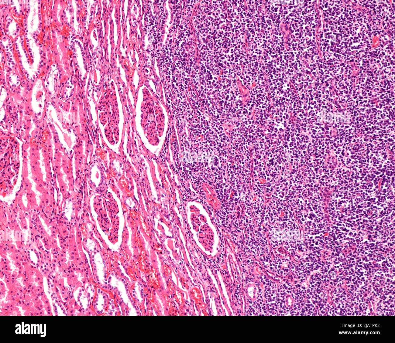 in human kidney, light micrograph Stock Photo Alamy