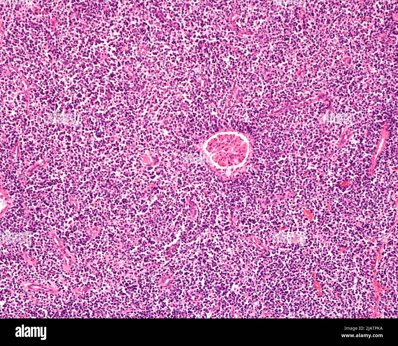 in human kidney, light micrograph Stock Photo Alamy