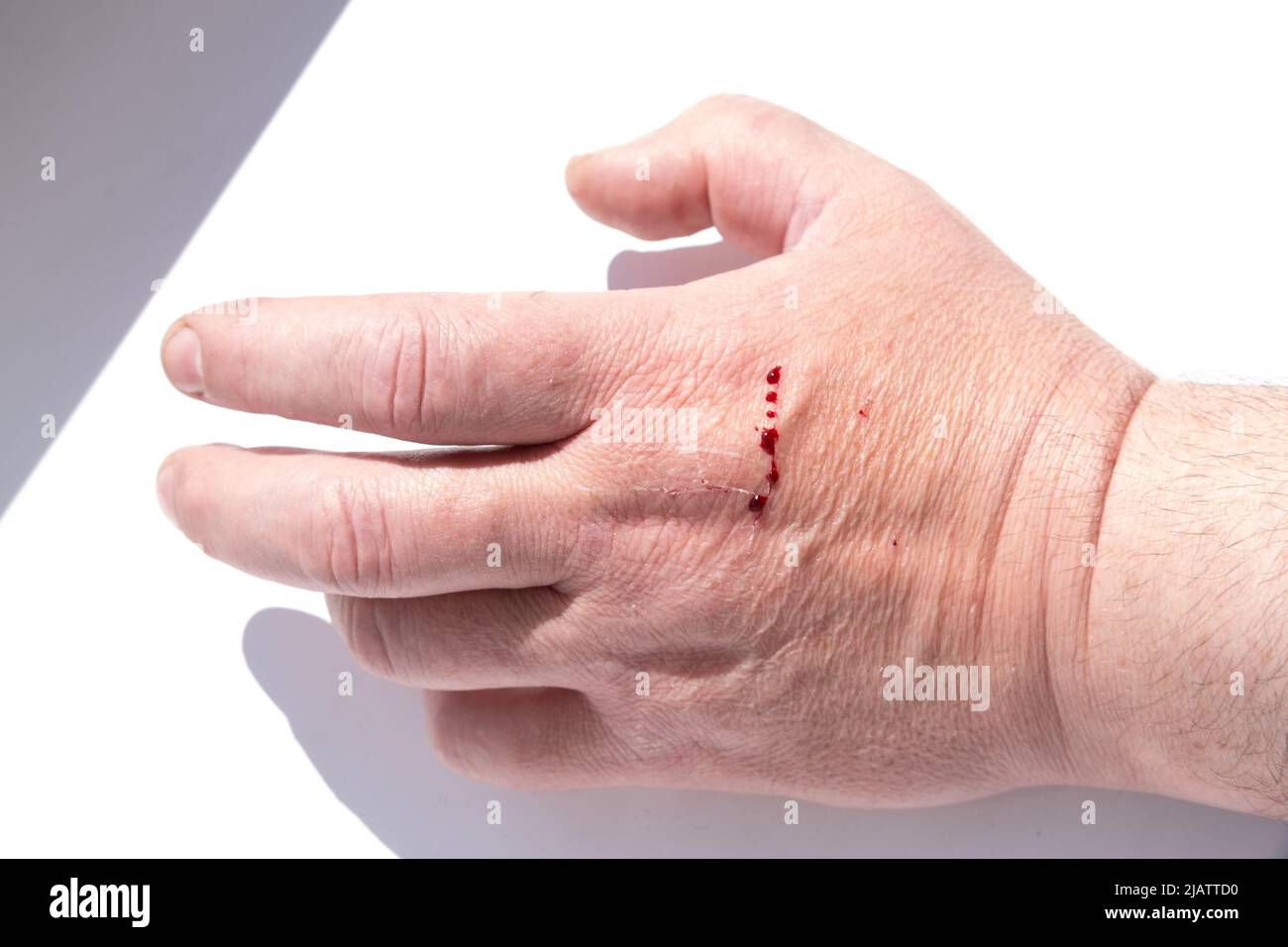Hand cut blood pic hotsell