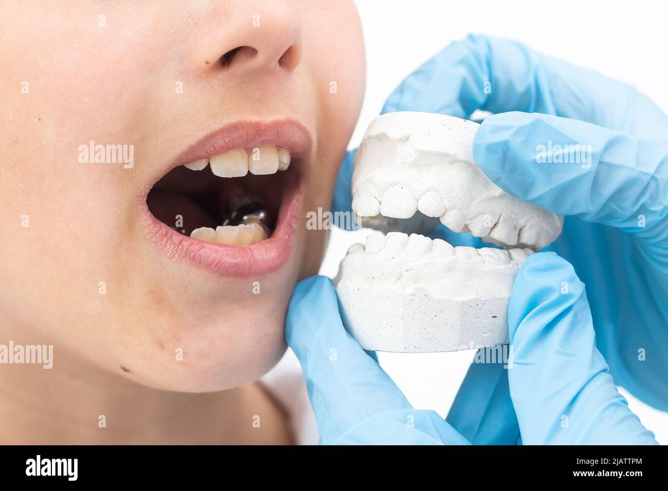 Orthodontist's hand, covered in a blue medical glove holding a dental