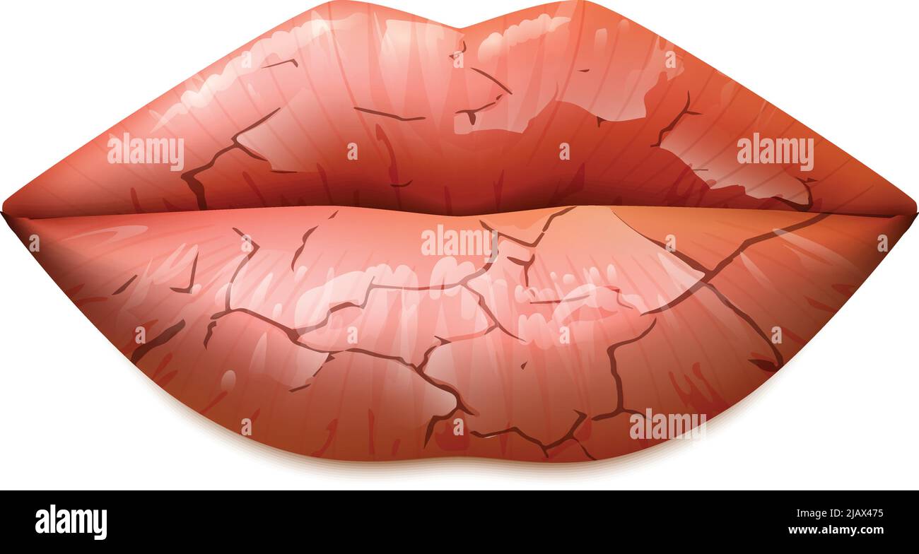 Dry cracked woman lips in a classic shape realistic isolated vector ...