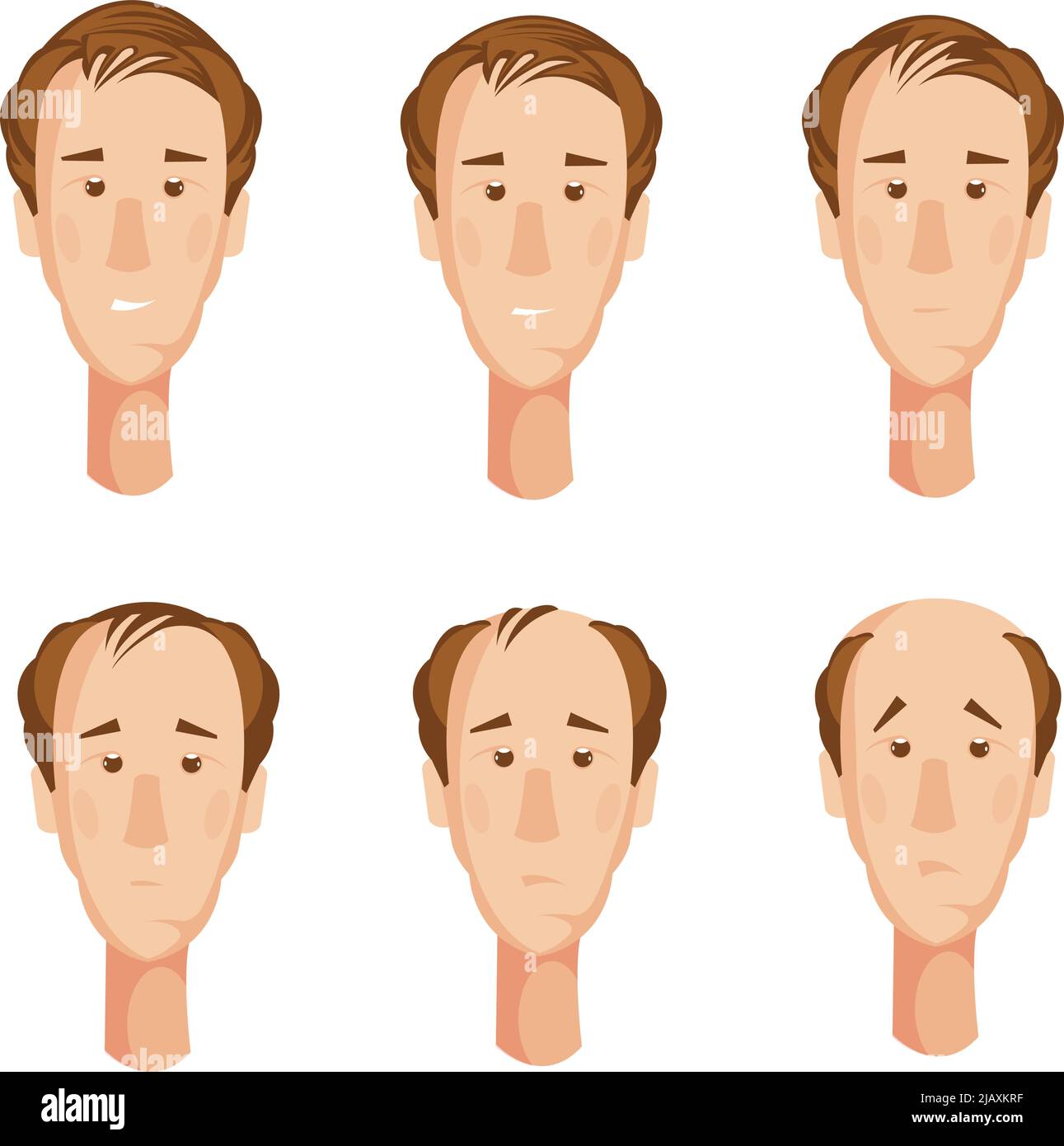 Storyboard with six isolated cartoon male character heads suffering from hair  loss with unhappy facial expressions vector illustration Stock Vector Image  & Art - Alamy