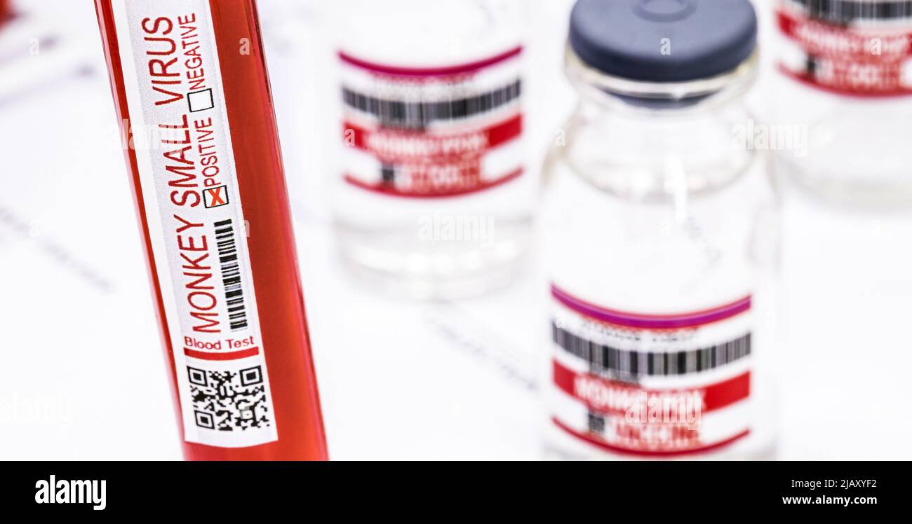 tubes for blood collection with blood contaminated by monkeypox ...