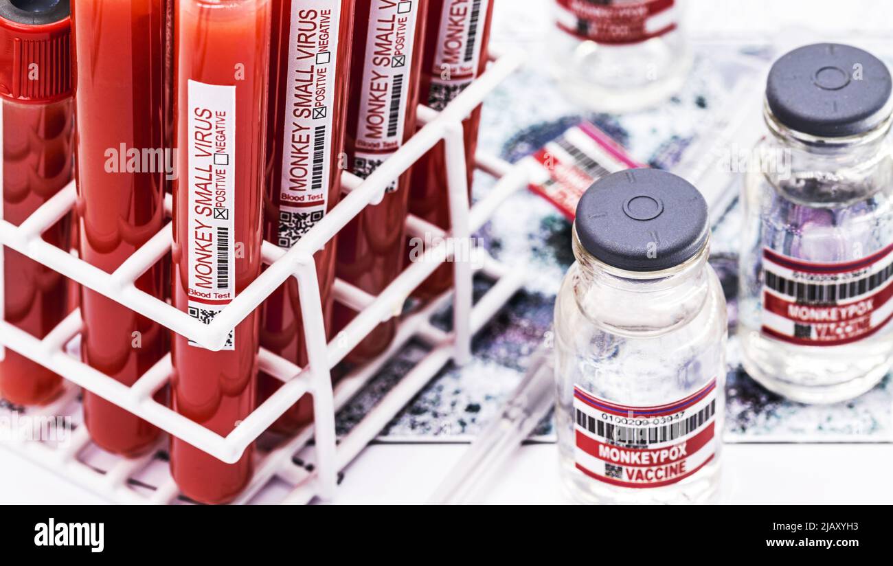 tubes for blood collection with blood contaminated by monkeypox ...