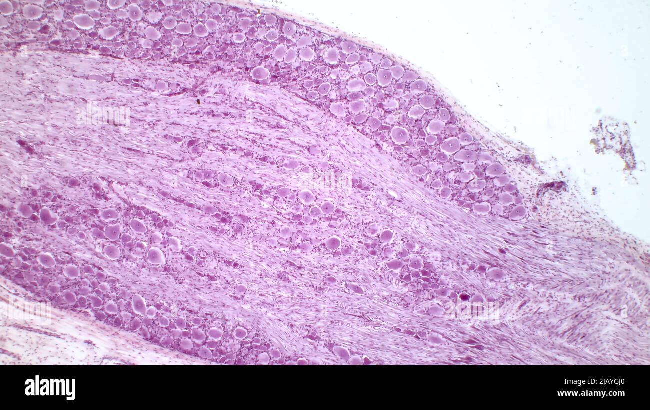 Dorsal root ganglion. Pseudounipolar neurons of a dorsal root ganglion. Hematoxlyn and eosin stain. Magnification: x40. Stock Photo