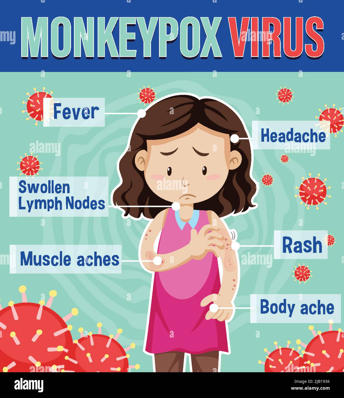 A woman with monkeypox symptoms infographic illustration Stock Vector ...