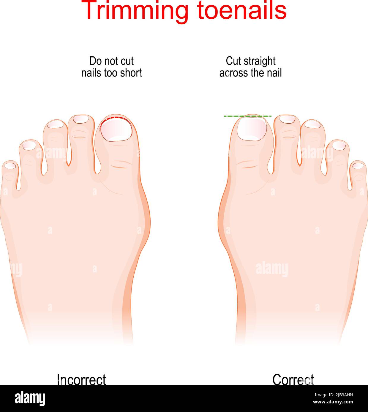 How To Cut Your Toenails Like a Professional : r/FeetFirstClinic