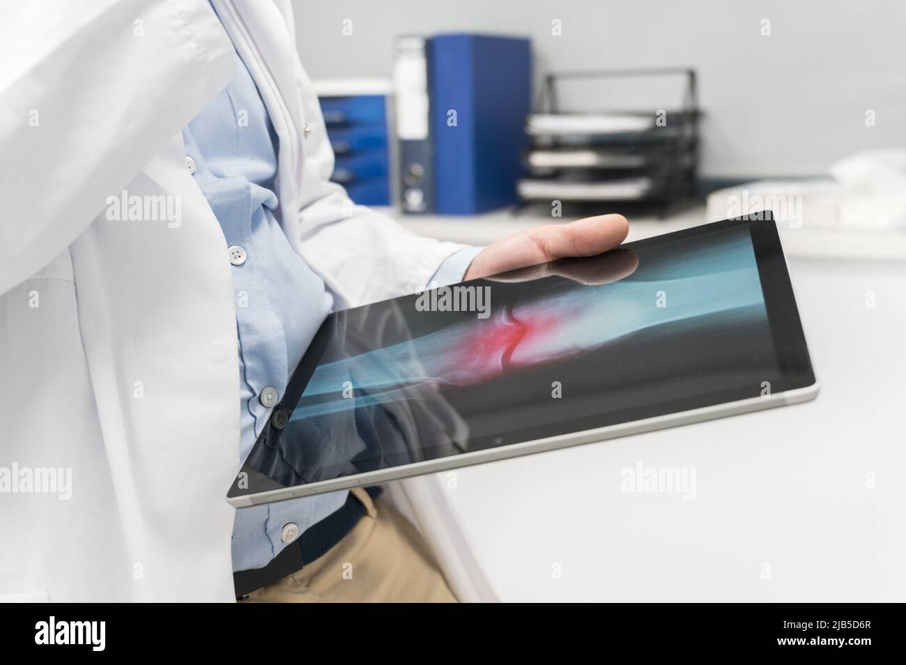 Unrecognizable Doctor is checking x-ray image at computer tablet, close up. Doctor at work in a hospital. Medicine and healthcare concept. High Stock Photo