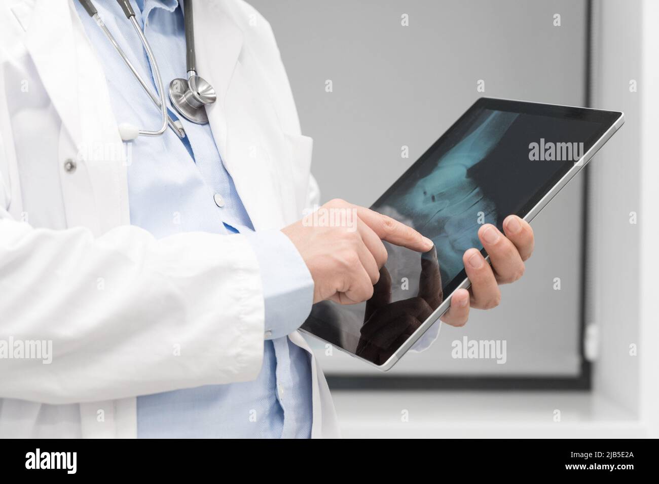 Unrecognizable Doctor is checking x-ray image at computer tablet, close up. Doctor at work in a hospital. Medicine and healthcare concept. High Stock Photo