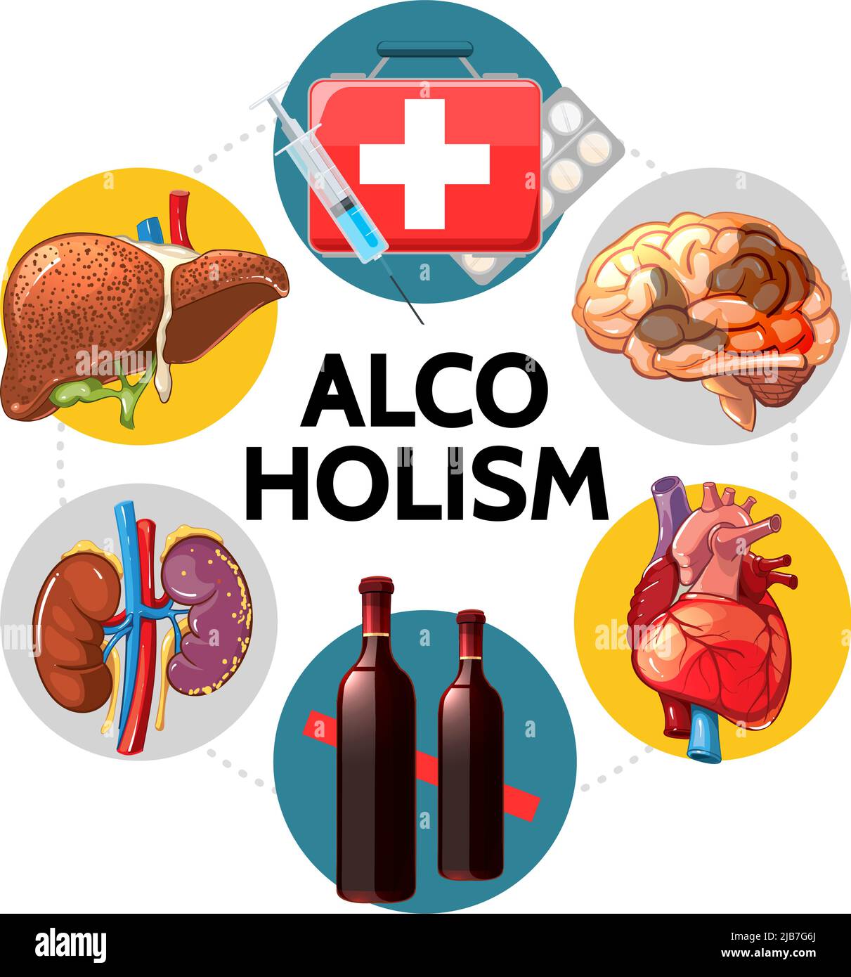 Cartoon alcoholism bad effects concept with sick liver brain heart kidneys medical box pills syringe wine bottles isolated vector illustration Stock Vector