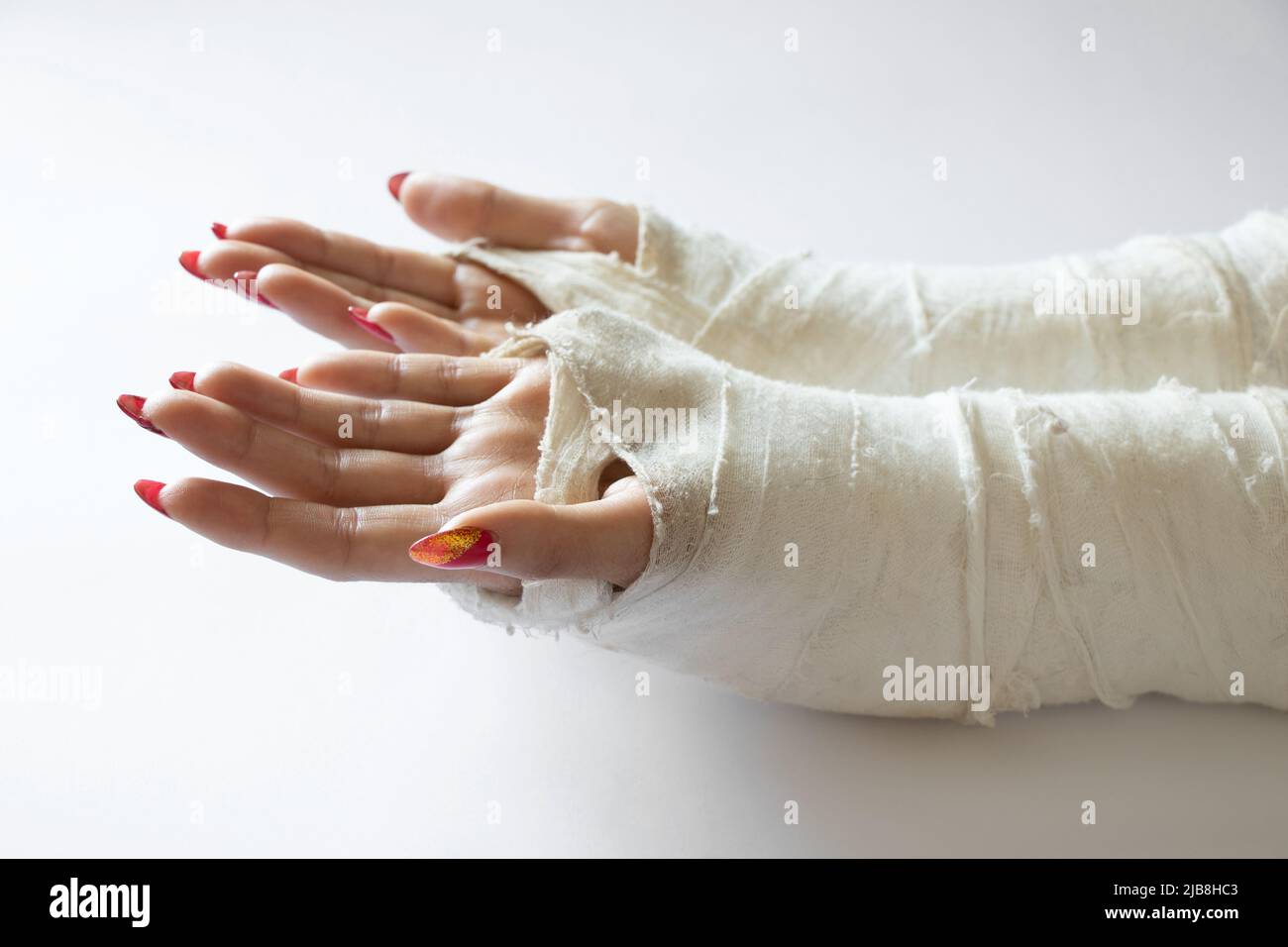 two female hands with broken wrists after falling from a bicycle in a cast on an isolated background, hands in a cast Stock Photo