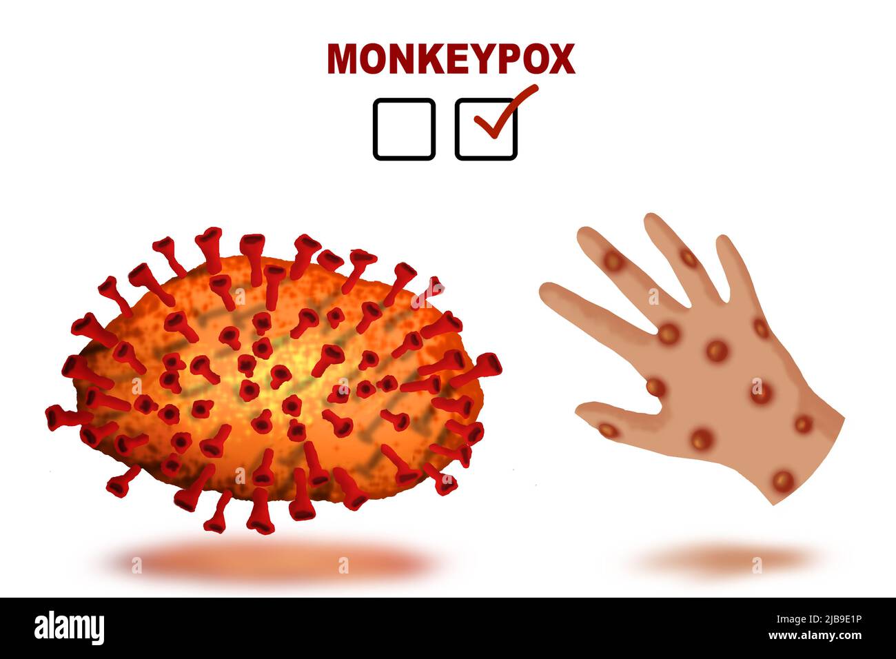 Monkeypox on skin and monkeypox virus illustration Stock Photo