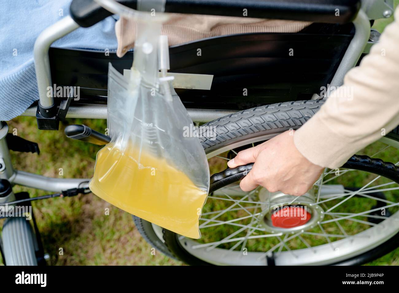 Asian lady woman patient sitting on wheelchair with urine bag in the