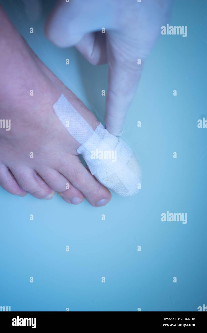 Foot big toe bandage injured feet in medical clinic hospital center