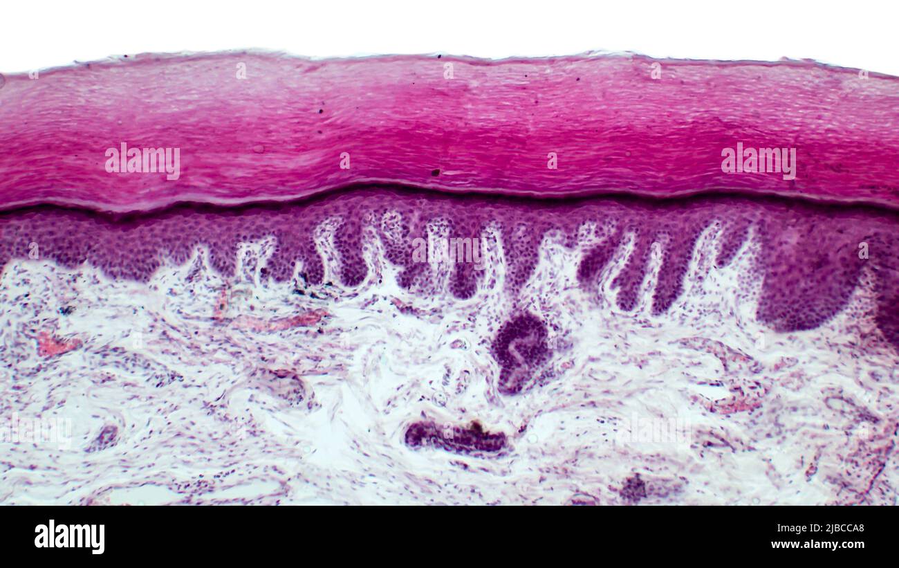 Skin. Light micrograph of epithelial tissue from the skin. Human finger section showing epidermis, dermis and connective tissues.Hematoxylin and eosin Stock Photo