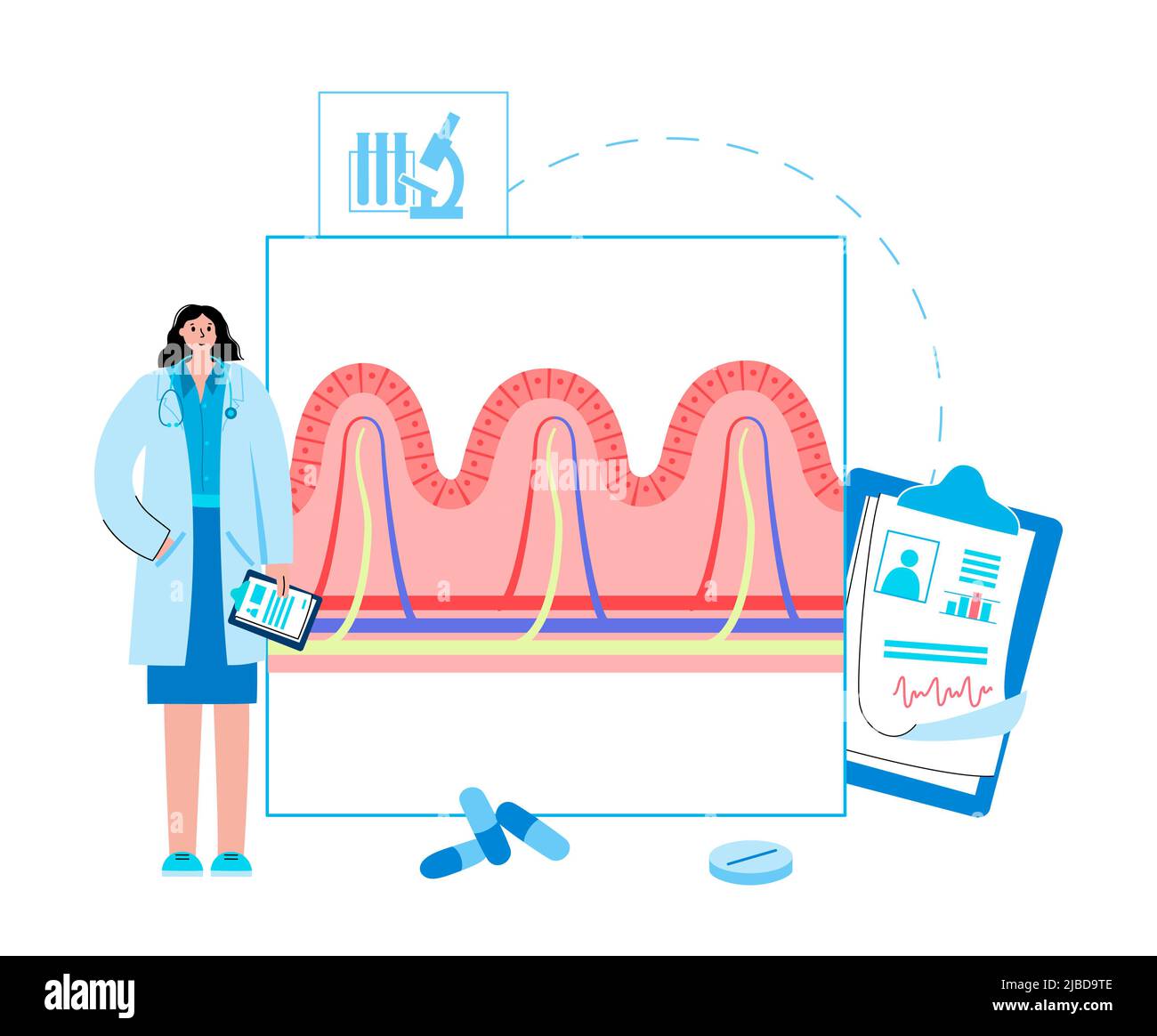 Celiac disease inflammation, illustration Stock Photo - Alamy