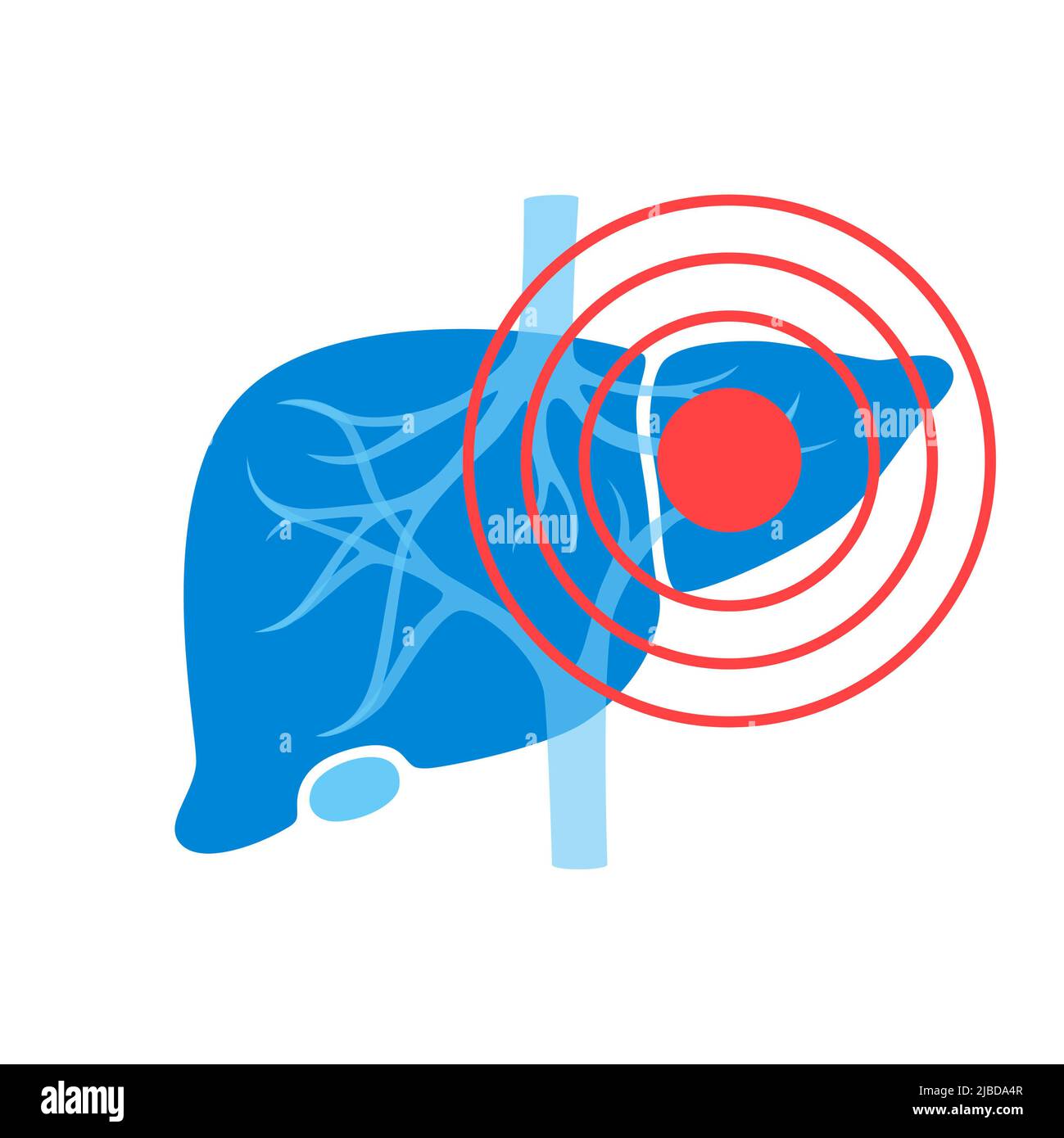Liver disease, conceptual illustration Stock Photo Alamy