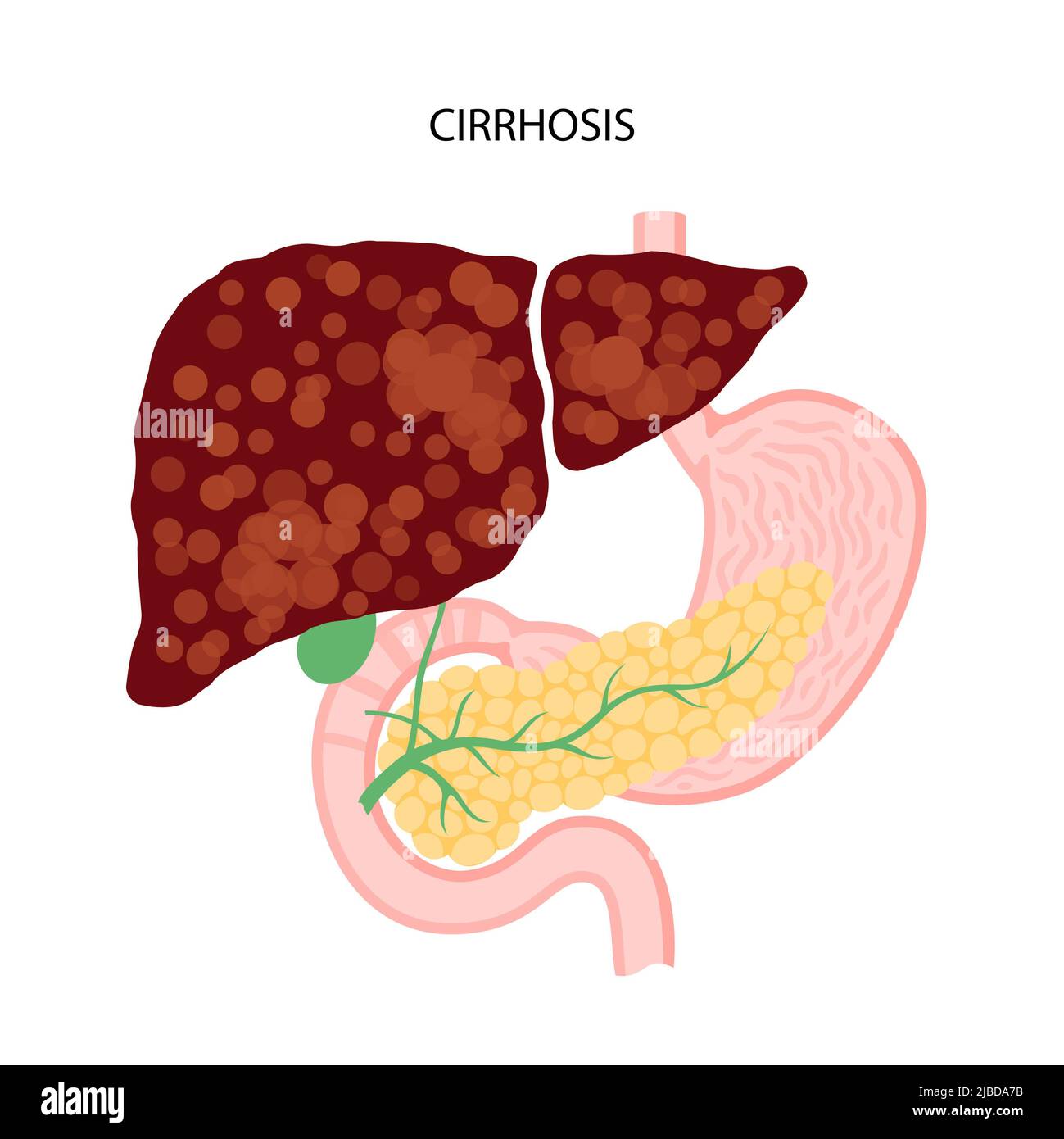 Liver disease, illustration Stock Photo Alamy
