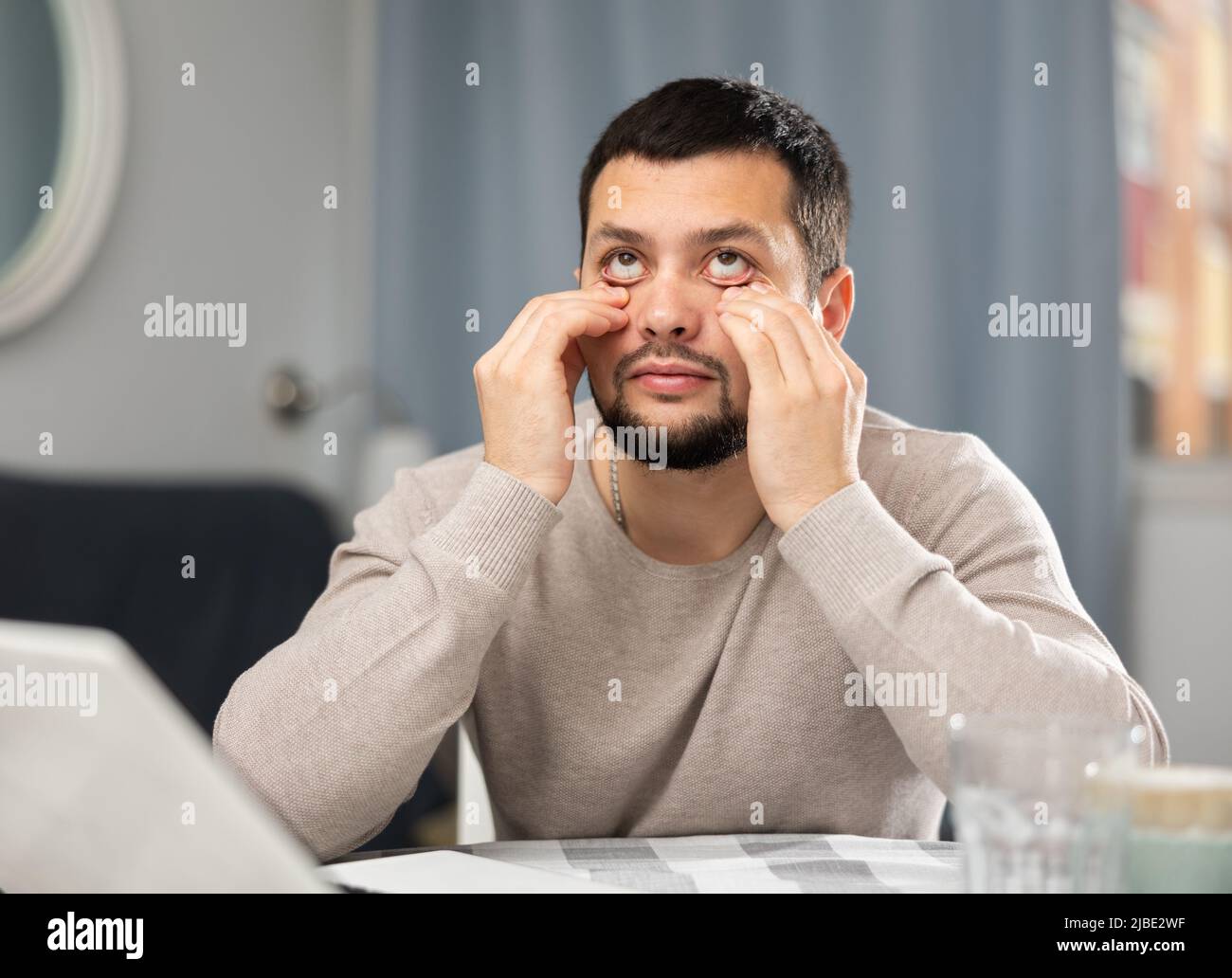 Young man suffering from eye pain after work on laptop at home Stock
