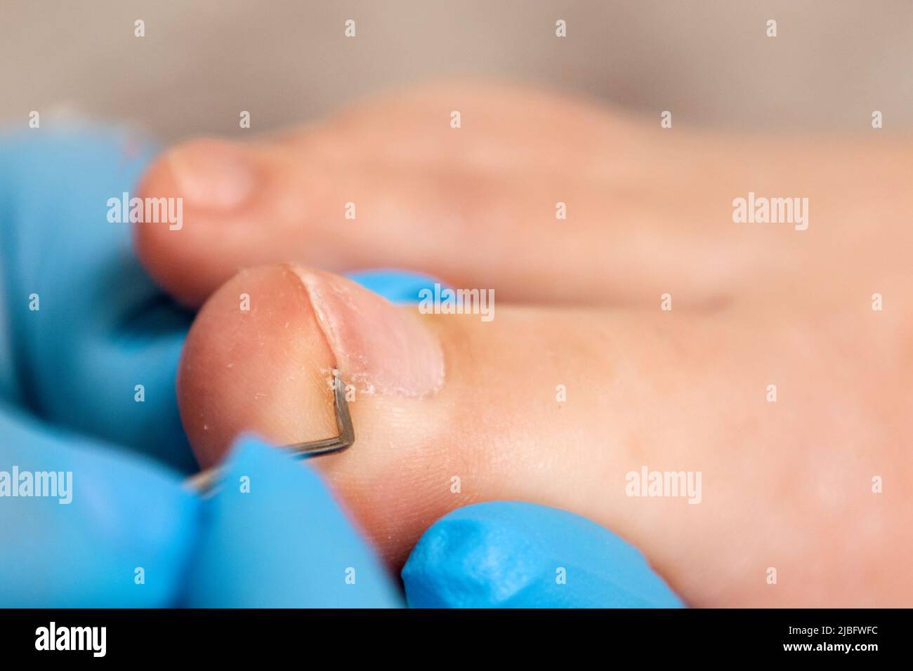 A chiropodist does a pedicure for the client's feet, cleaning the nails