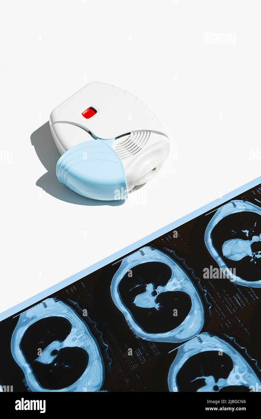 Asthma inhaler and CT scan of the lungs on white table. Aerosol for inhalation for treat lung inflammation and prevent asthma attack. Stock Photo