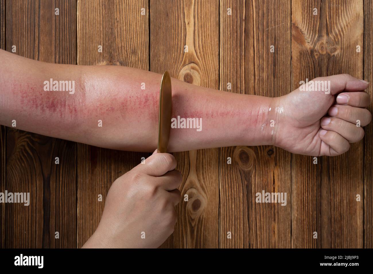 man scraping his arm by a copper scratcher which is a traditional