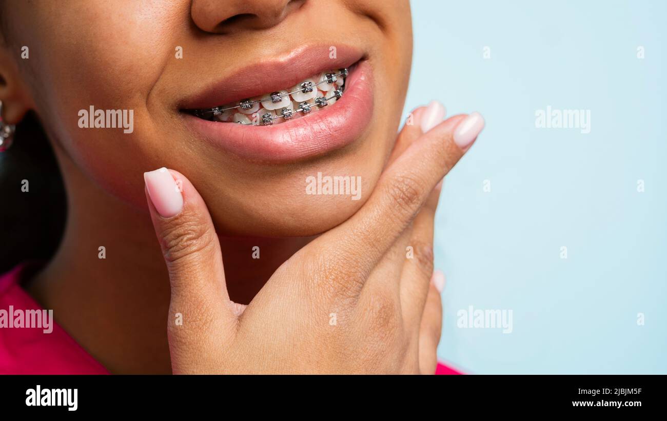 Teeth with braces. Closeup unrecognizable  Non-Caucasian Skinned woman smile with orthodontic accessories in blue background in studio. Stock Photo