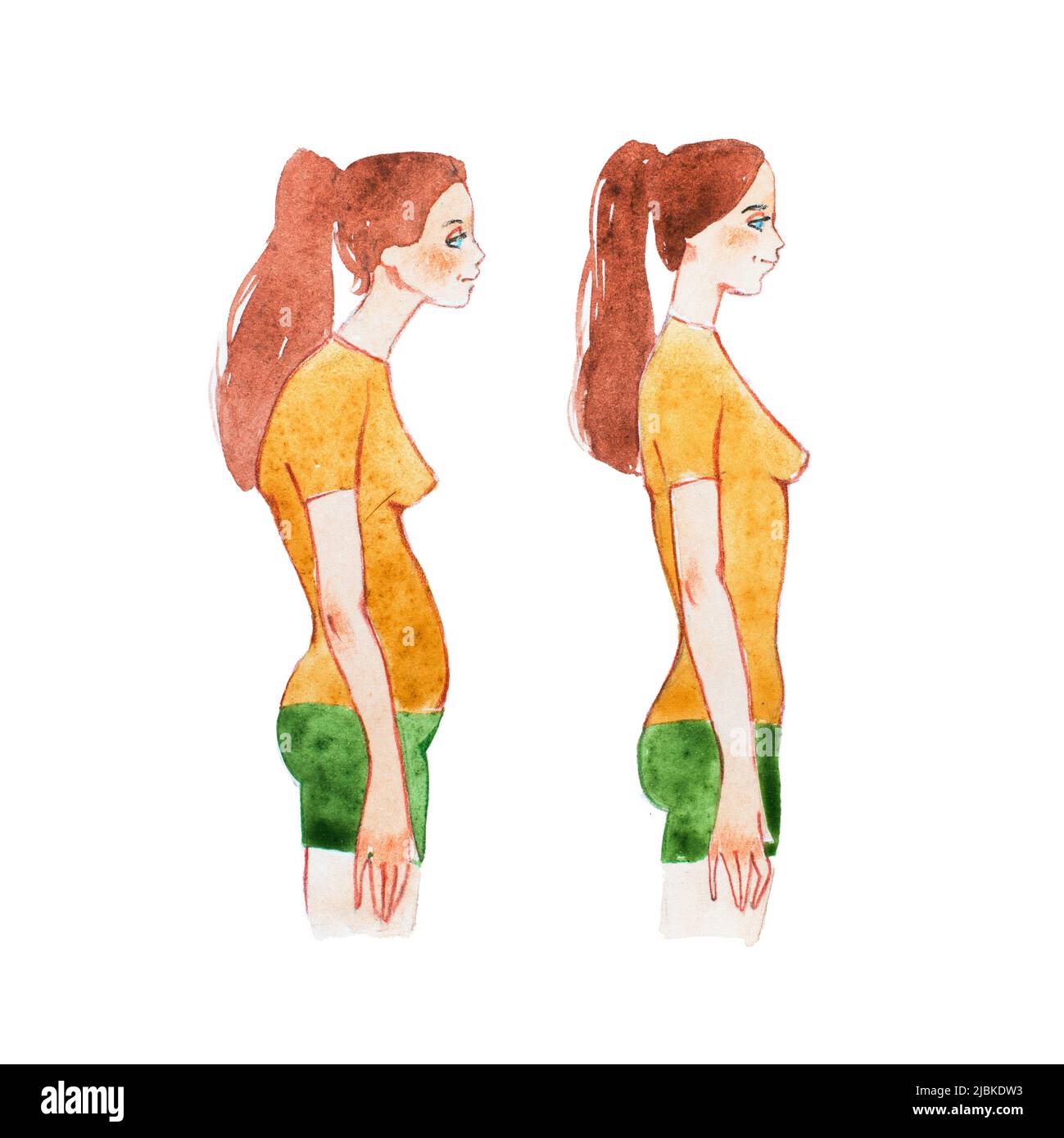 Hunchback posture hi-res stock photography and images - Alamy