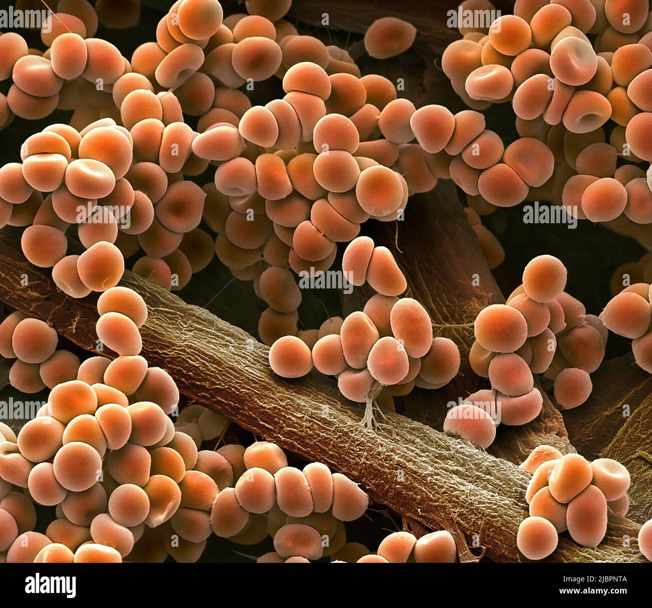 Enlarged red blood cells. Conceptual coloured scanning electron ...