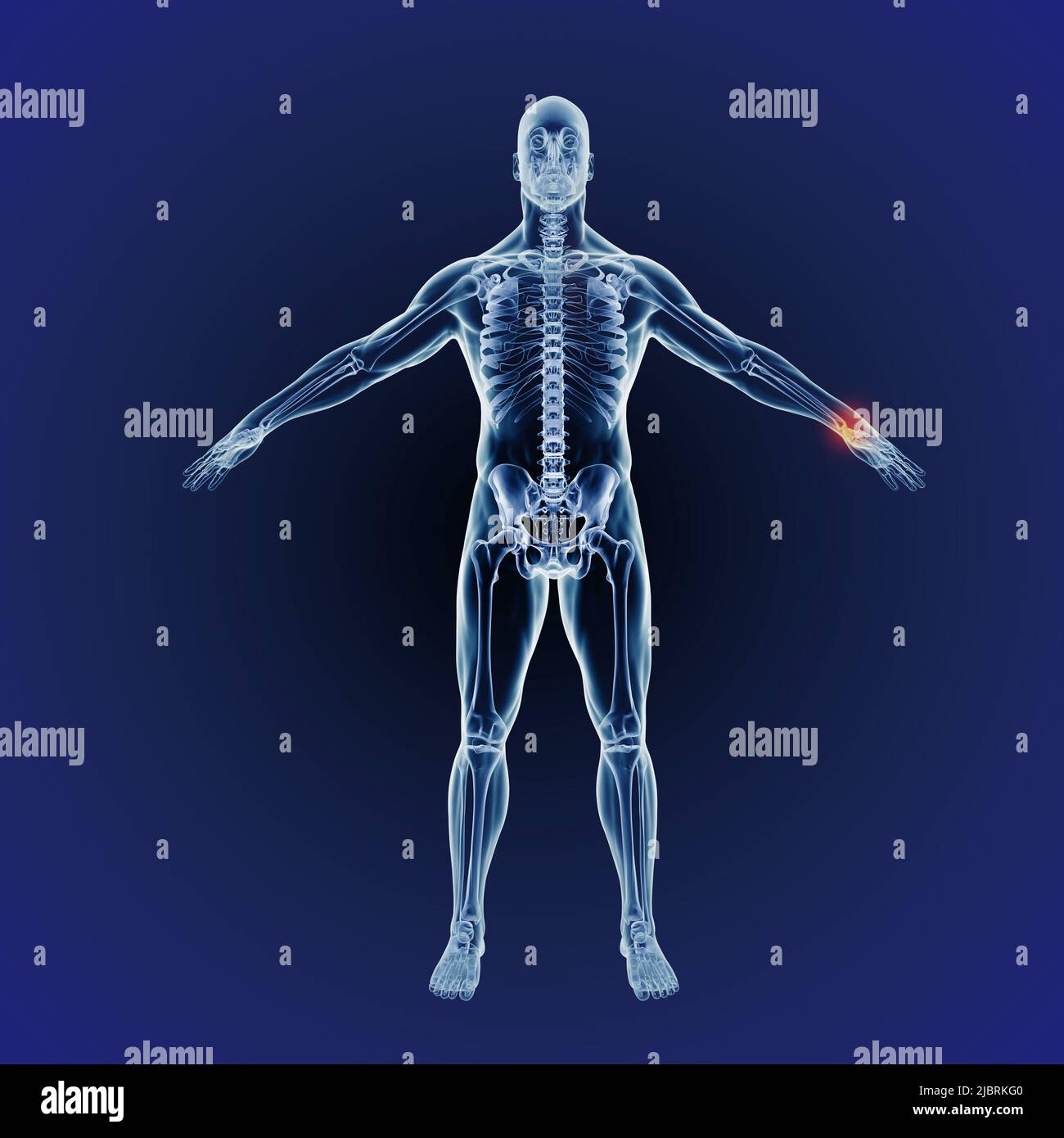Wrist and inflammation pains. When inflammation strikes. A full length cgi representation of the human body indicating the skeletal structure. Stock Photo