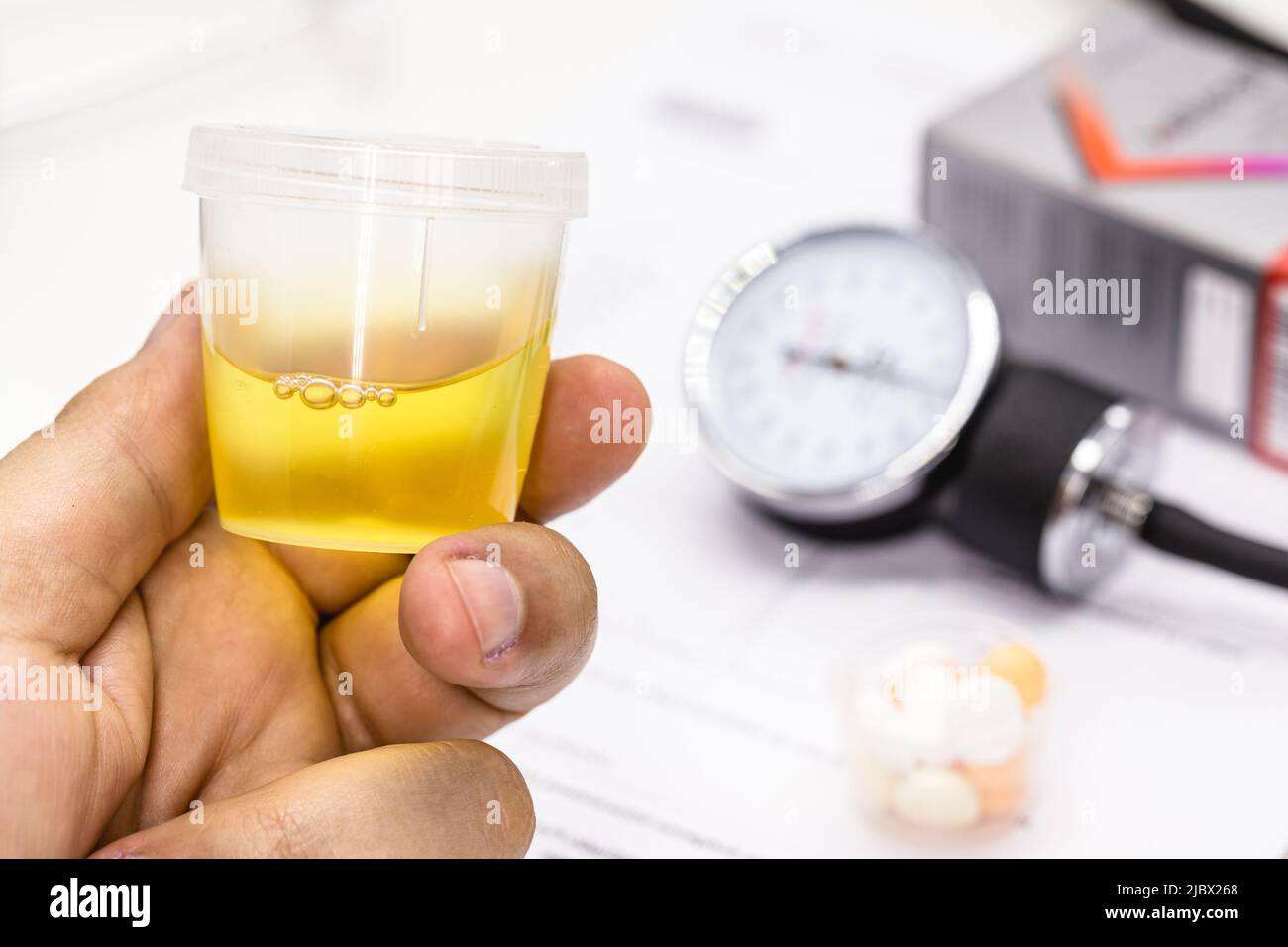 hand holding urine pot or bottle, delivering urine for medical