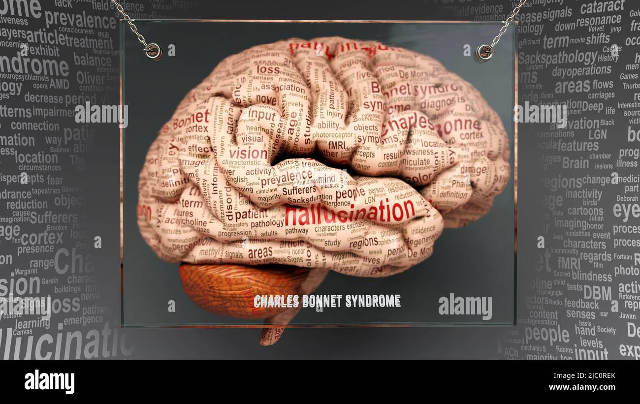 Charles bonnet syndrome in human brain - dozens of terms describing its ...