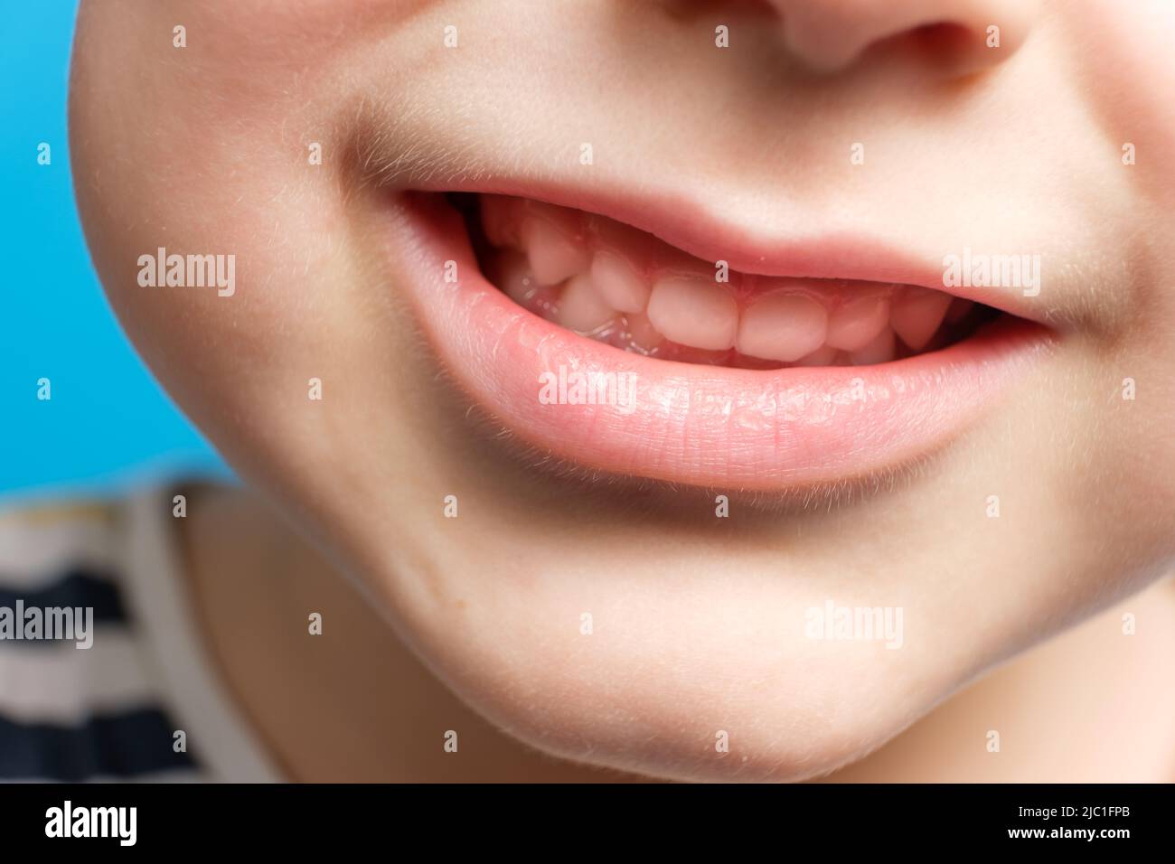Children's milk teeth in a child, open mouth, closeup. Pediatric