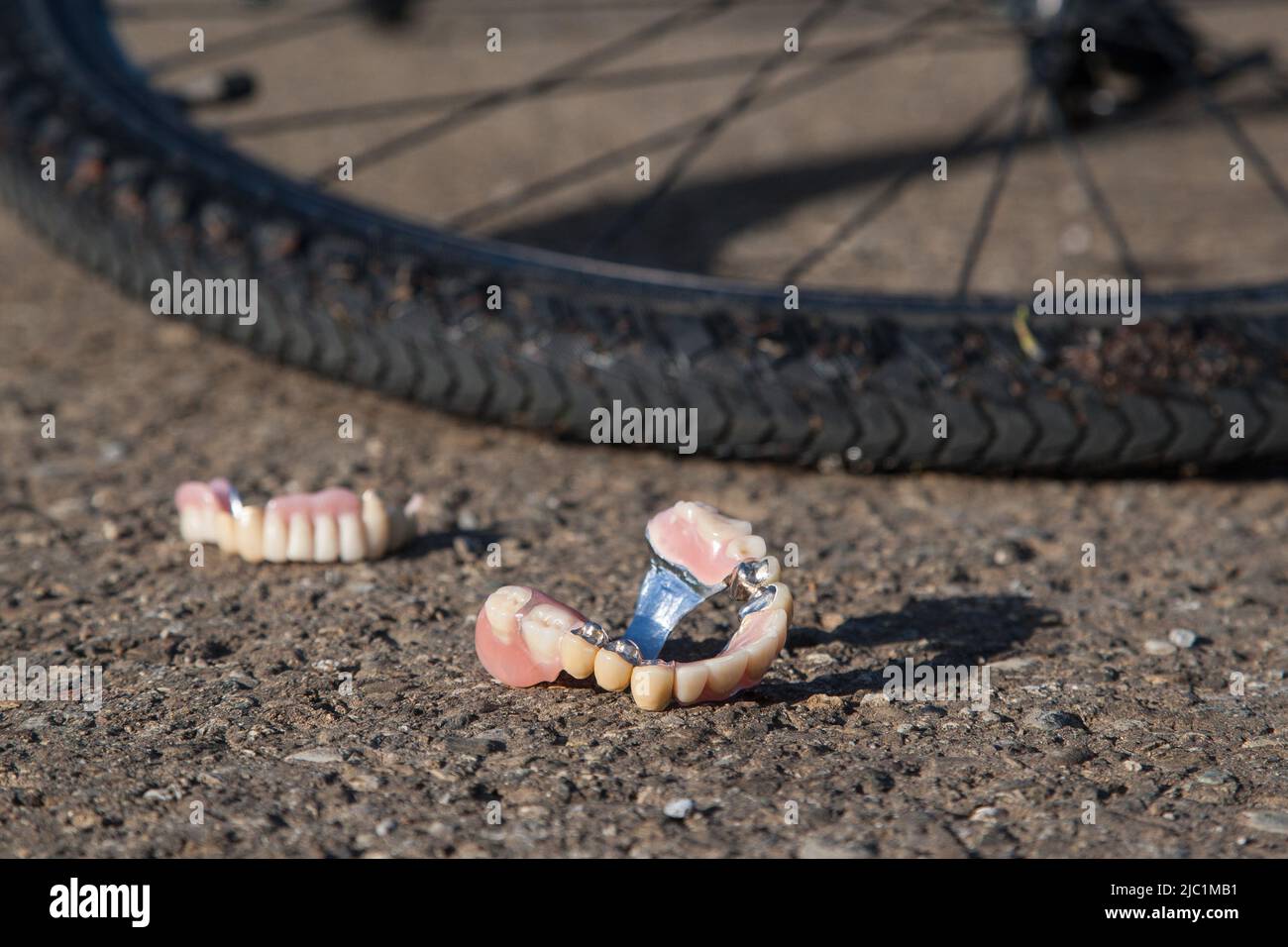 Denture and a fallen bike on the street. A fall from a bicycle often has tragic consequences. Stock Photo