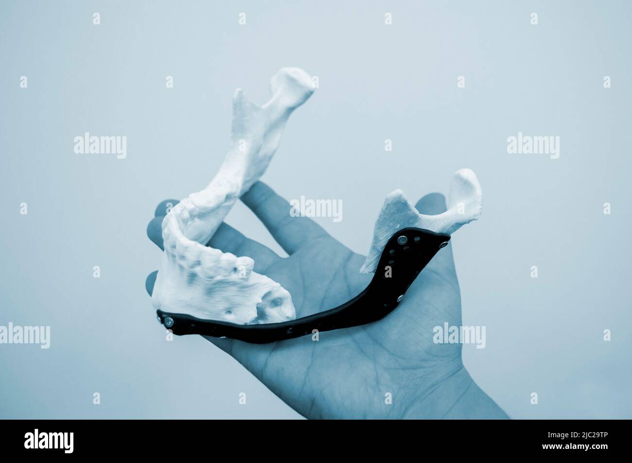 Person holding in hand facial mandibular endoprosthese printed on metal 3D printer from bionert titanium alloy close-up. 3D model bionic implants for maxillofacial Surgery. Lower jaw facial prostheses Stock Photo