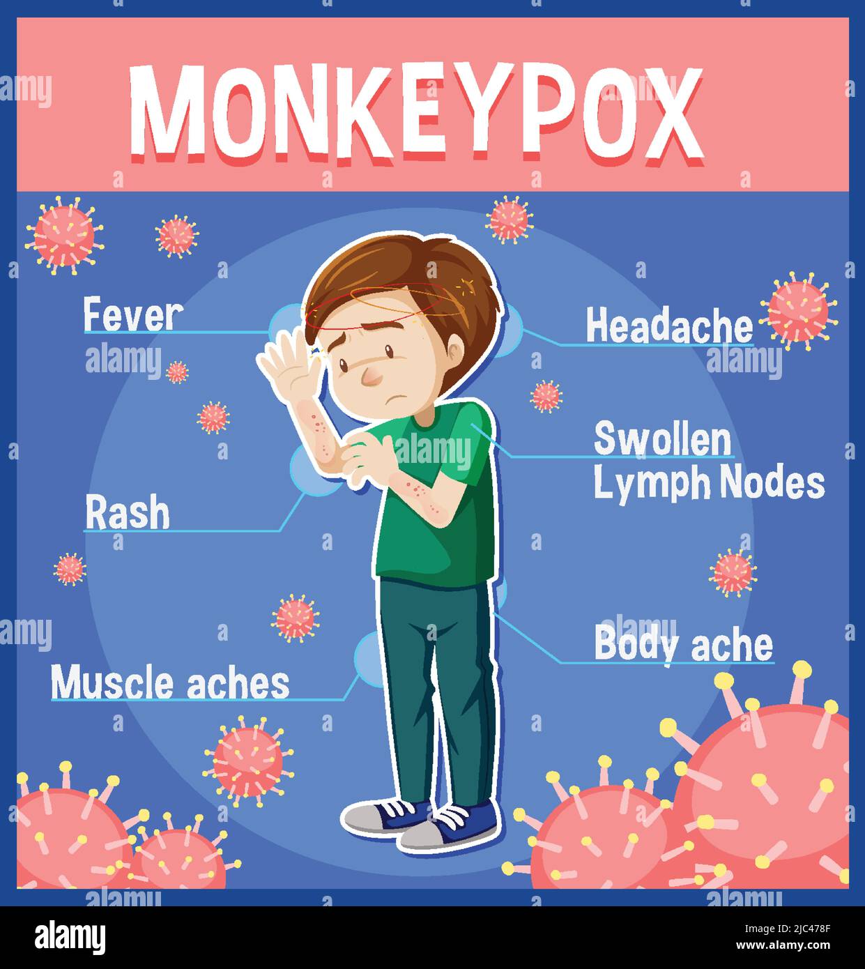 A man with monkeypox symptoms infographic illustration Stock Vector ...