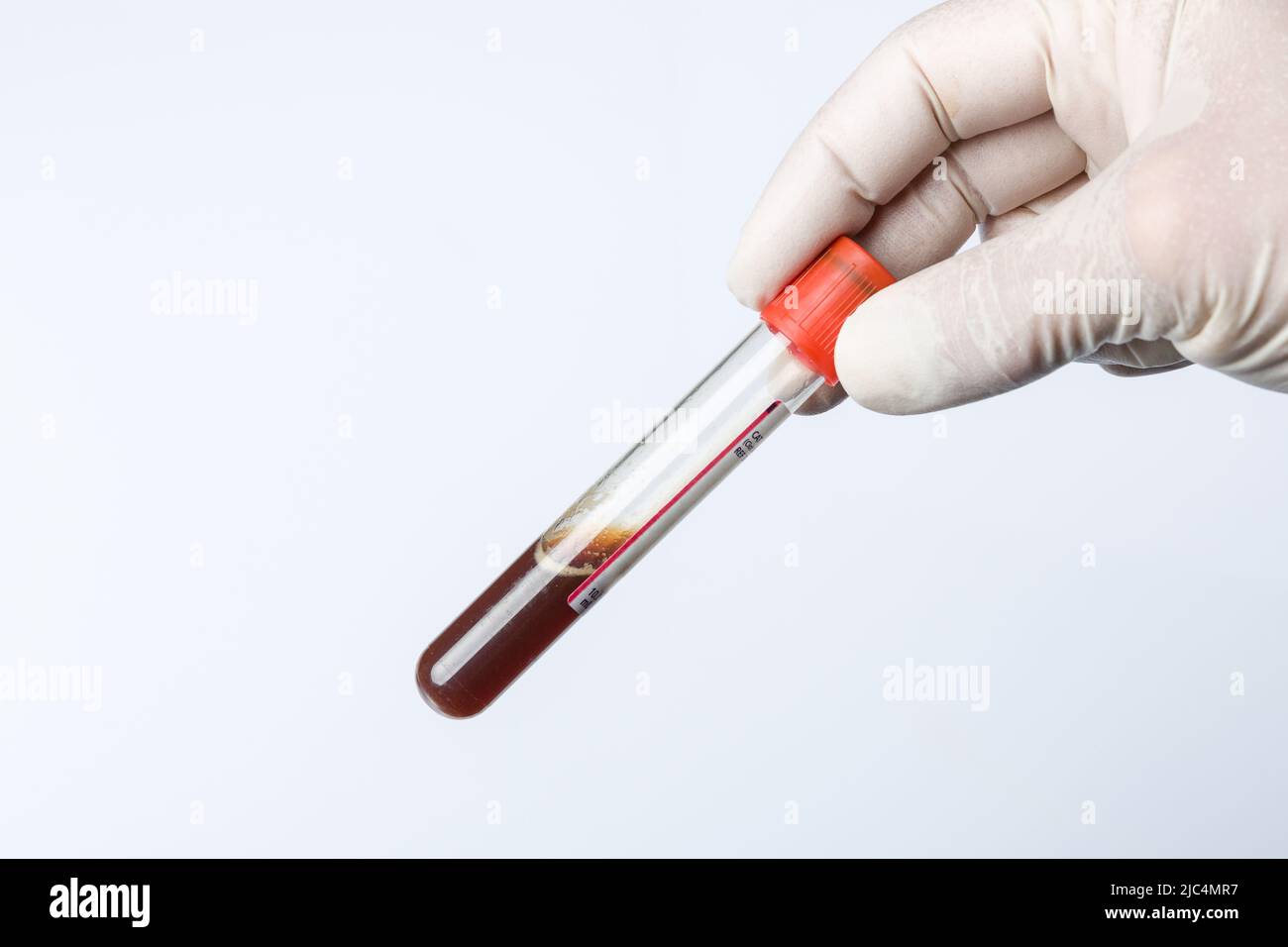 Handling blood probe for analyzing in a laboratory Stock Photo - Alamy